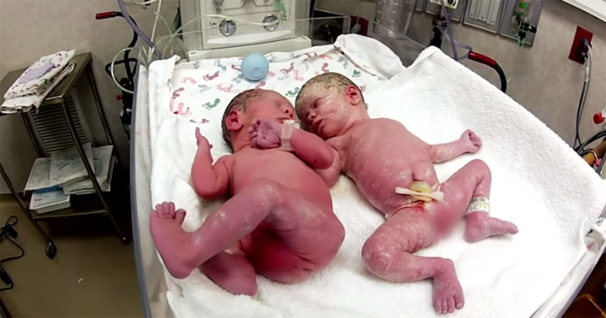 Nyfødte tvillinger græd indtil lægerne bragte dem sammen så skete det magiske